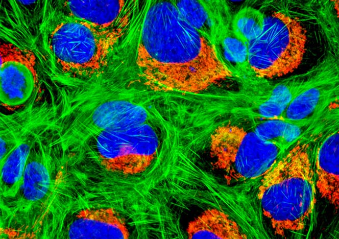 Human Bone Osteosarcoma Cells (U-2 OS Line)