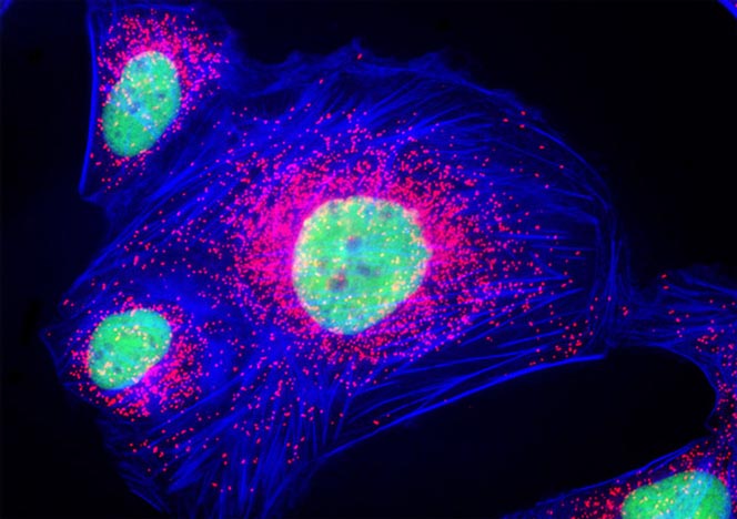 Human Bone Osteosarcoma Cells (U-2 OS Line)