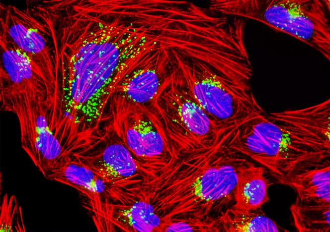 Human Bone Osteosarcoma Cells (U-2 OS Line)