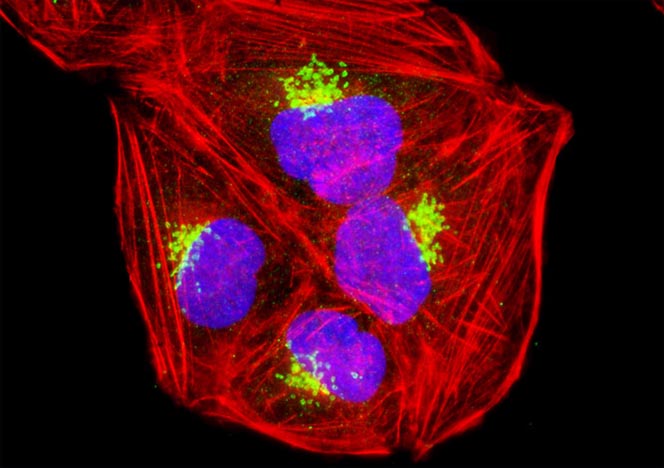 Human Bone Osteosarcoma Cells (U-2 OS Line)