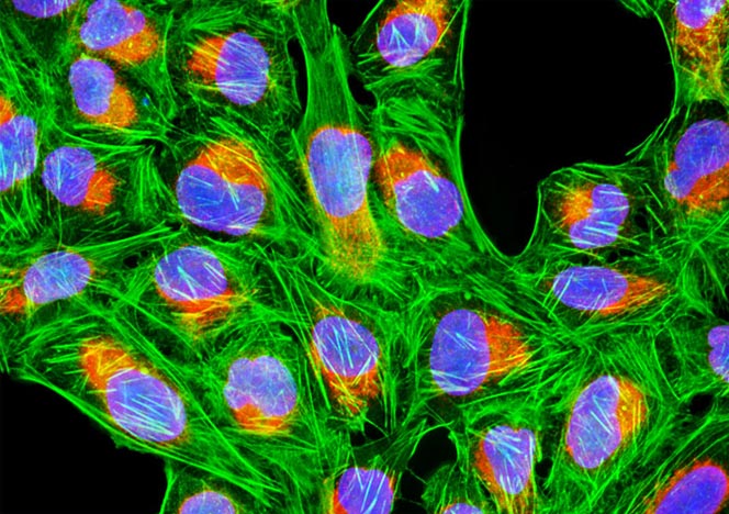 Human Bone Osteosarcoma Cells (U-2 OS Line)