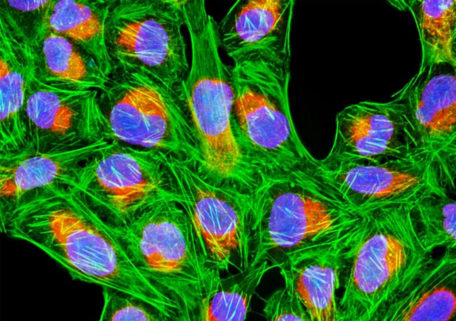 Human Bone Osteosarcoma Cells (U-2 OS Line)