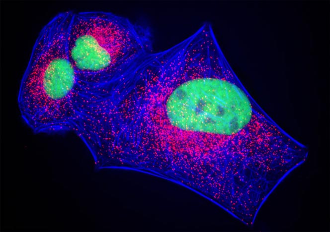 Human Bone Osteosarcoma Cells (U-2 OS Line)