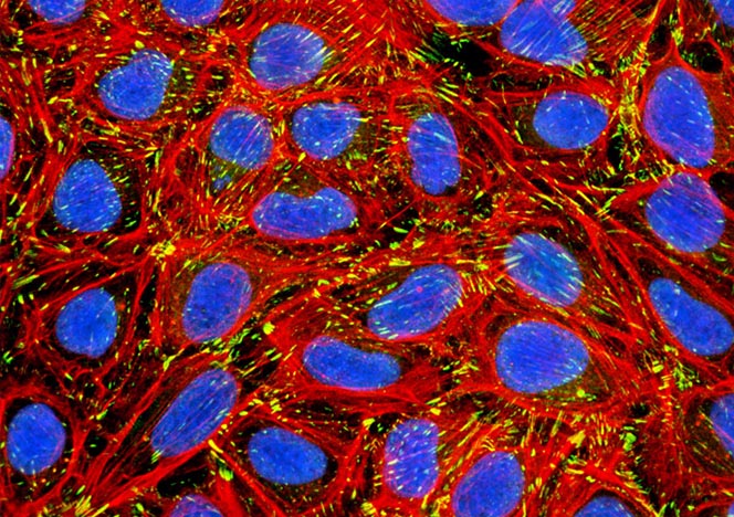 Human Bone Osteosarcoma Cells (U-2 OS Line)