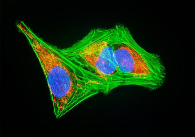 Human Bone Osteosarcoma Cells (U-2 OS Line)