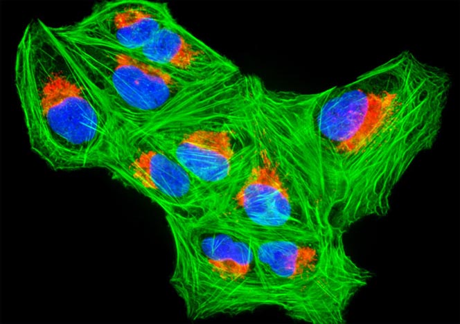 Human Bone Osteosarcoma Cells (U-2 OS Line)