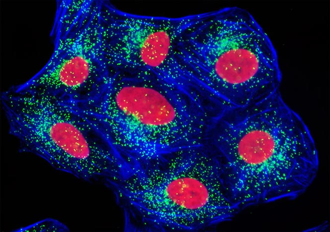 Human Bone Osteosarcoma Cells (U-2 OS Line)