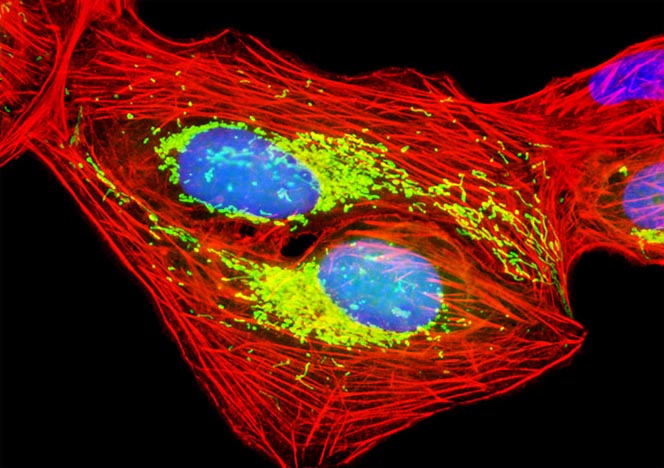 Human Bone Osteosarcoma Cells (U-2 OS Line)