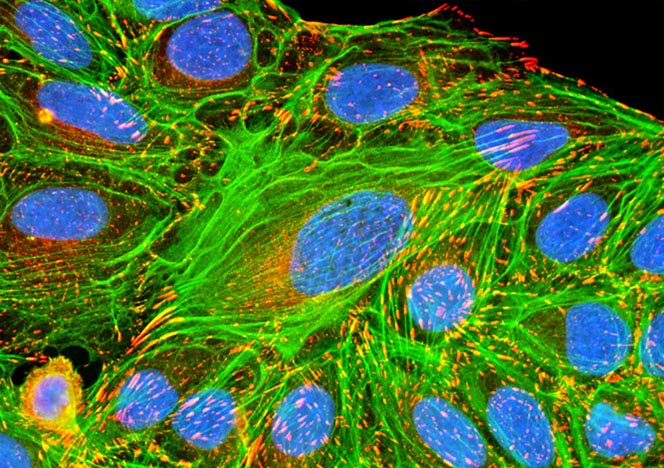 Human Bone Osteosarcoma Cells (U-2 OS Line)