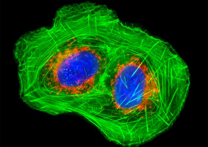 Human Bone Osteosarcoma Cells (U-2 OS Line)