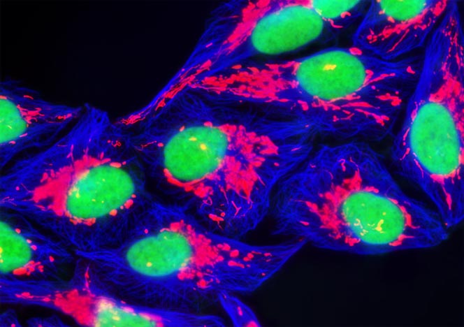 Human Bone Osteosarcoma Cells (U-2 OS Line)