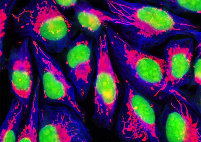 Human Bone Osteosarcoma Cells (U-2 OS Line)