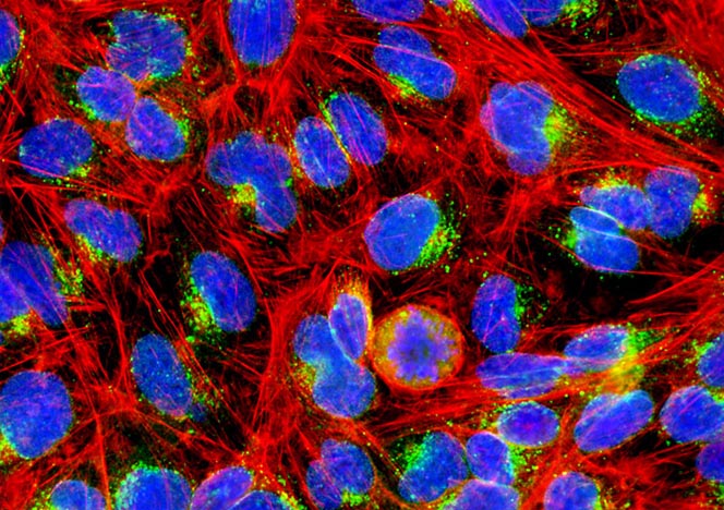 Human Bone Osteosarcoma Cells (U-2 OS Line)