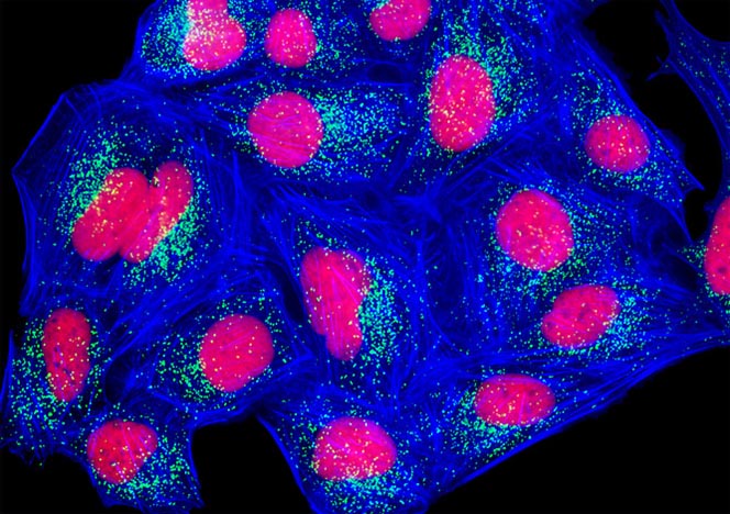 Human Bone Osteosarcoma Cells (U-2 OS Line)