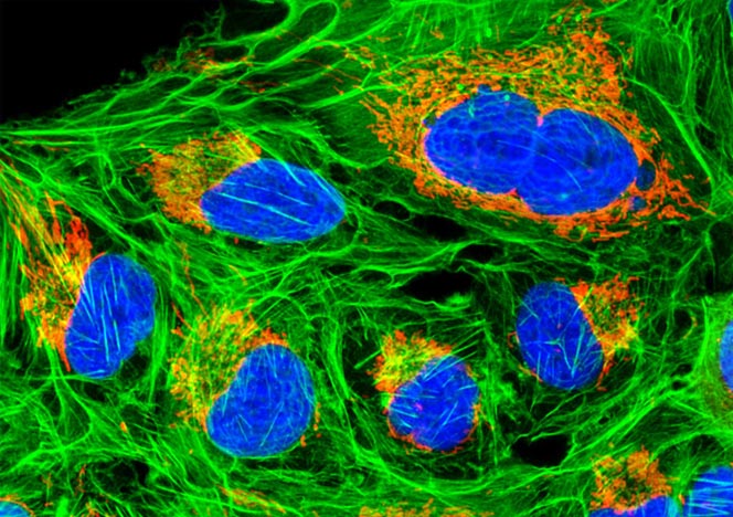 Human Bone Osteosarcoma Cells (U-2 OS Line)