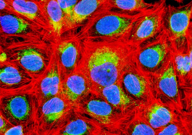 Human Bone Osteosarcoma Cells (U-2 OS Line)