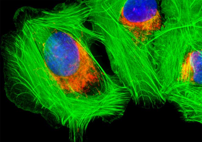 Human Bone Osteosarcoma Cells (U-2 OS Line)