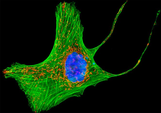 Human Bone Osteosarcoma Cells (U-2 OS Line)