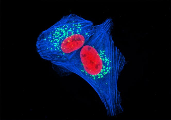 Human Bone Osteosarcoma Cells (U-2 OS Line)