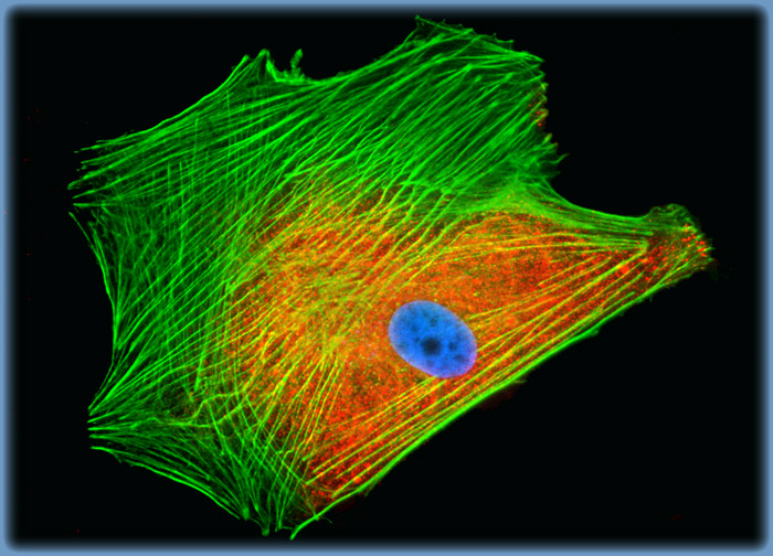 Normal African Green Monkey Kidney Epithelial Cells (Vero)