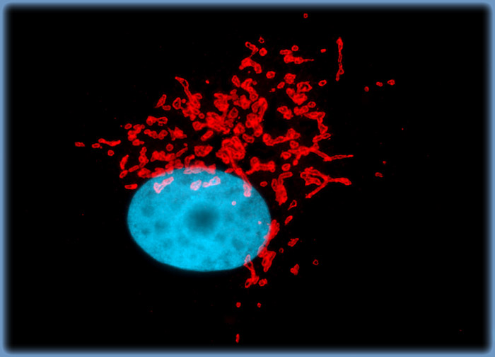 Normal African Green Monkey Kidney Epithelial Cells (Vero)