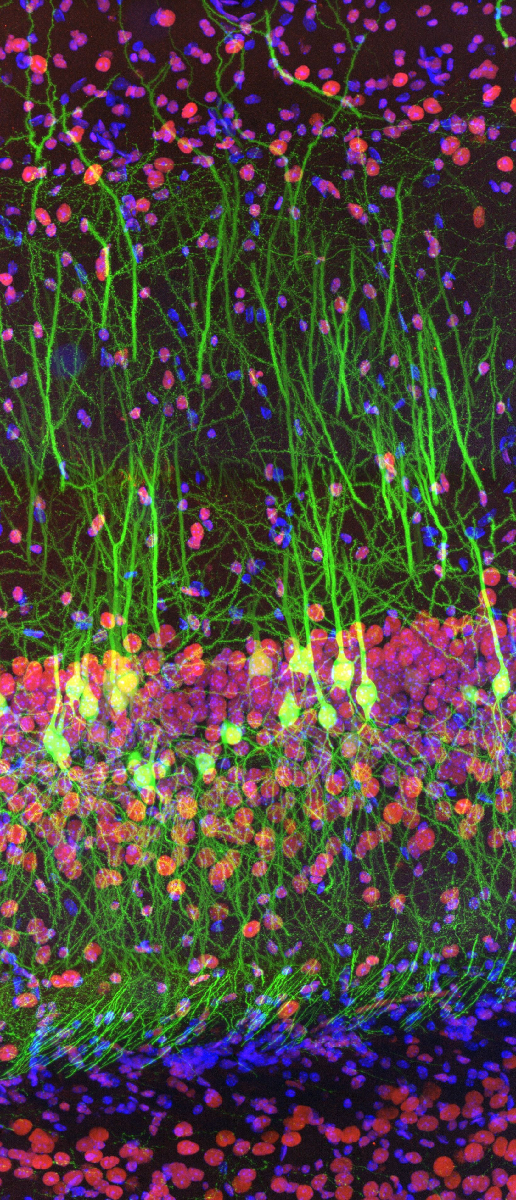 Unveiling Nanoscopic Realms: A Journey into Super-Resolution Microscopy