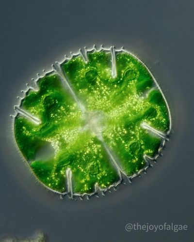 显微镜下的绿藻。