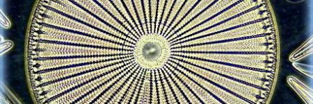 蛛网藻的暗视场显微图像