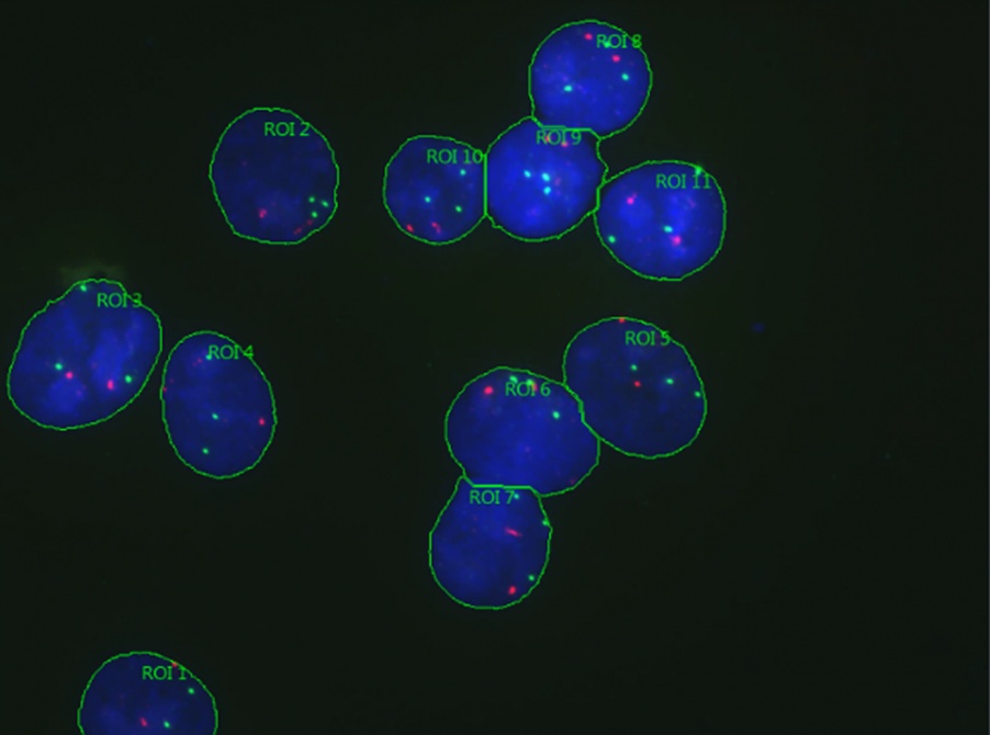 在cellSens Dimension图像软件中，通过计测工具将显微镜图像中的蓝色细胞核区域标记为感兴趣区（ROI），并对该区域内的红色和绿色点状信号进行计数测量