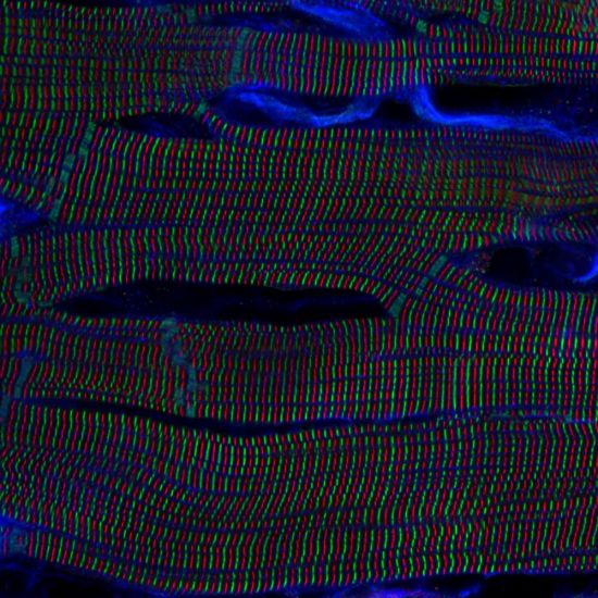 Evident Image of the Year Award 2025: APAC Winner. Sarcomere structures within cardiomyocytes in a rat heart. Captured by Kentaro Mochizuki, Japan.
