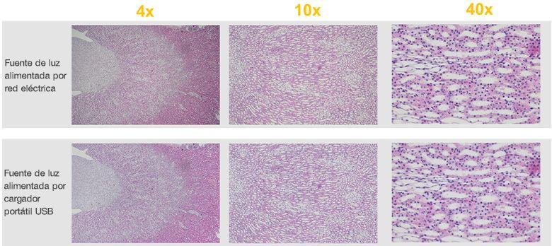 Comparación entre las imágenes microscópicas CX23 obtenidas a partir de la fuente de luz alimentada por red eléctrica y la fuente de luz alimentada por baterías