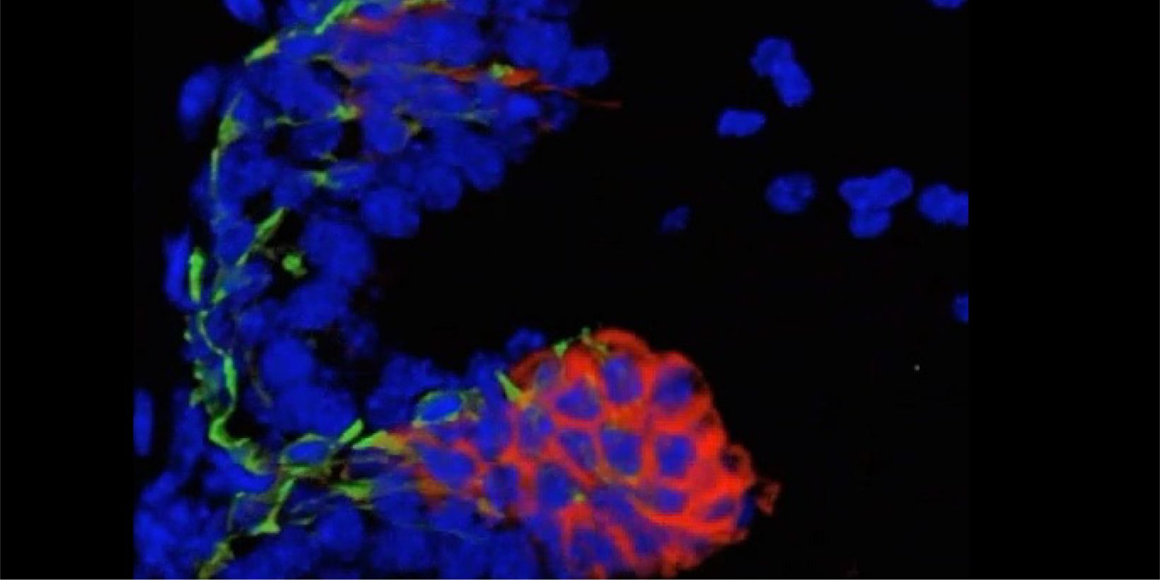 Prostate Cell Lineage Hierarchy and Plasticity