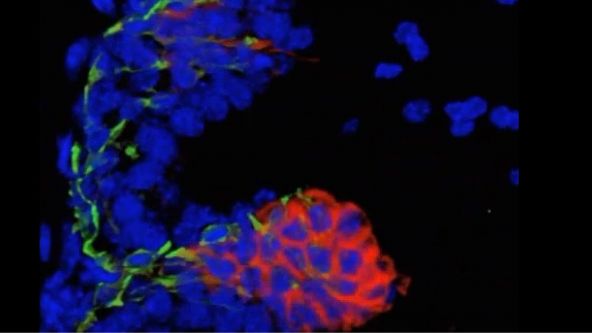 Prostate Cell Lineage Hierarchy and Plasticity