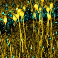 Confocal Microscopy