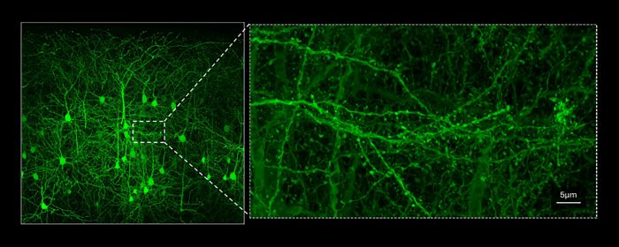  Mouse brain slice captured on the FLUOVIEW FV5000 confocal laser scanning microscope.