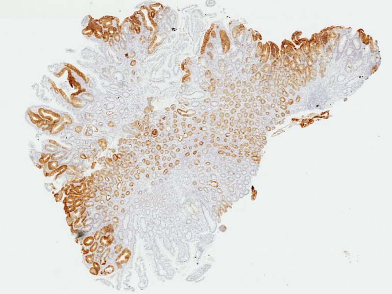 腺瘤组织样品的应用图像