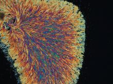 Polarized Microscopy and What It Can Teach Us About the Materials That Make Up Our Skeletal Tissue