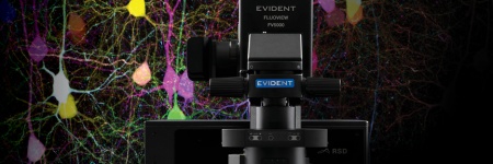 Confocal laser scanning microscopy