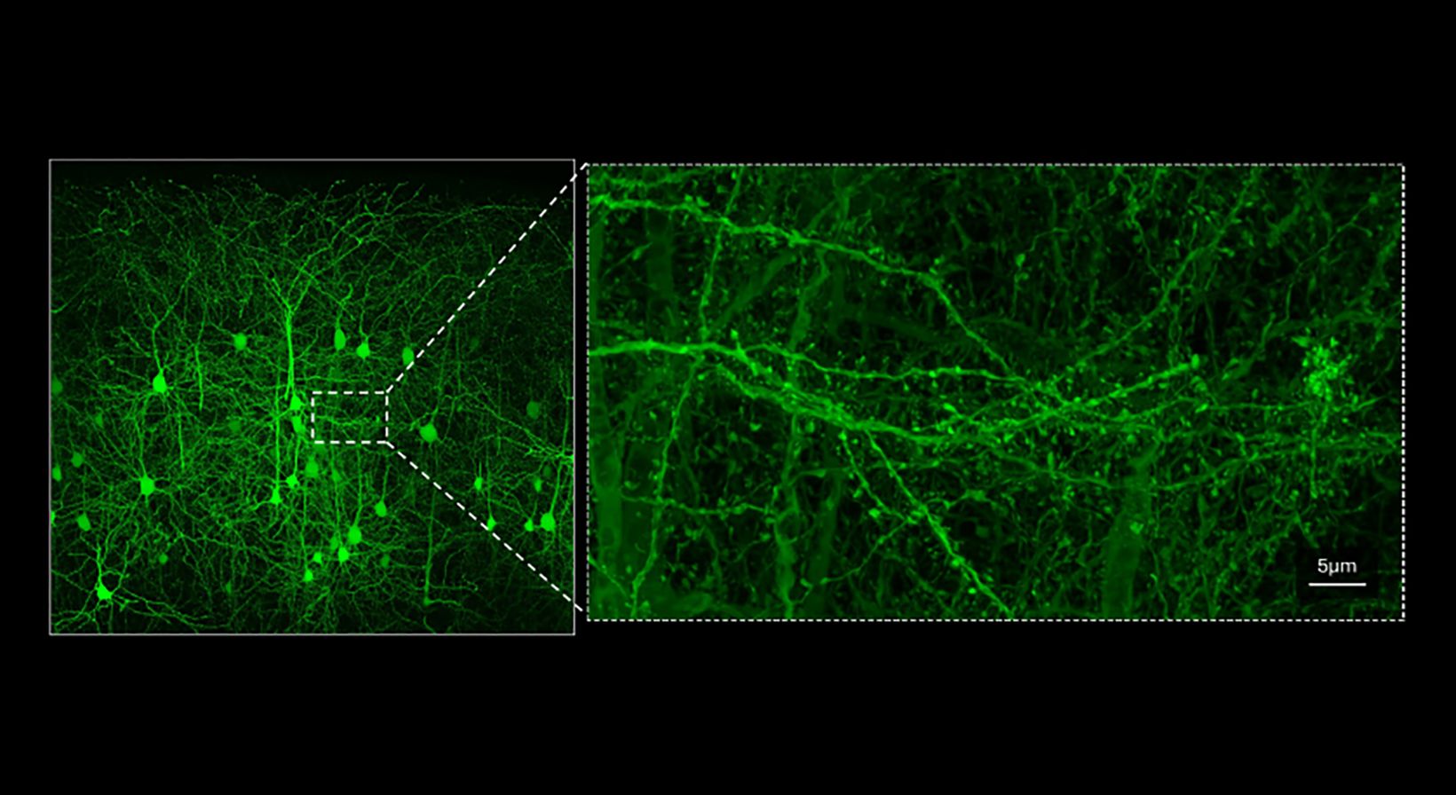 Unmatched dynamic range combined with effortless Nyquist, big picture, and fine details. Galvo 8192 × 8192, zoom 0.9x, 0.8 a.u., LUPLAPO25XO objective lens, Ypet: 514 / 530-570, Z: 60-150 µm, Z step: 0.82 µm, MIP. 