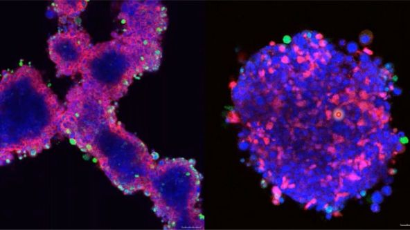 An In Vitro System for Evaluating Anticancer Drugs Using Patient-Derived Tumor Organoids