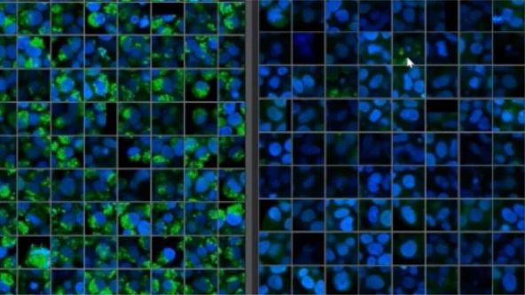 NoviSight™ Demonstration: 3D Image Analysis and Statistical Software for Organoids and Spheroids