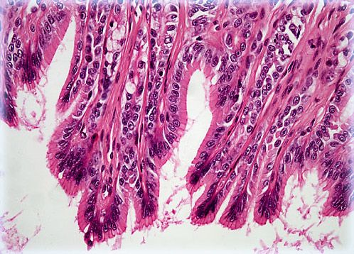 epithelial tissue图片