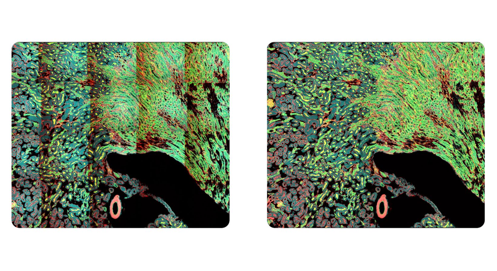 Comparison stitched images without Intelligent Shading Correction (left) and with Intelligent Shading Correction (right). 