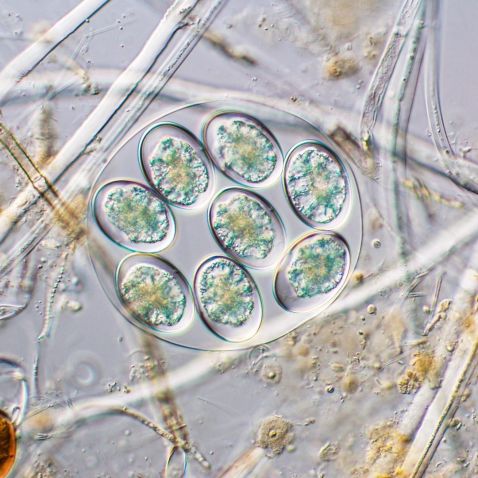 显微镜下的单细胞藻类