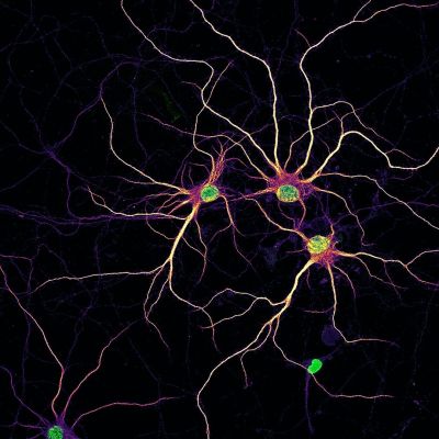 体外培养 14 天原代大鼠皮层神经元的图像，具有细胞核（绿色）和发育中的树突 (mpl-inferno LUT)，为显示神经元轮廓而添加了 MAP2 染色 