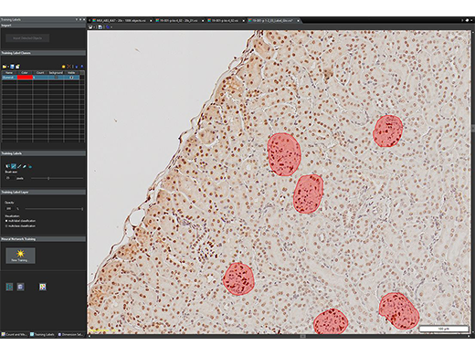 cellSensを用いた画像解析