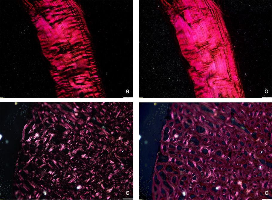 Images of connective tissue and bone under linear and circular polarized light