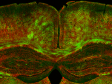 转盘共聚焦显微镜推进了阿尔茨海默病的脑髓鞘研究