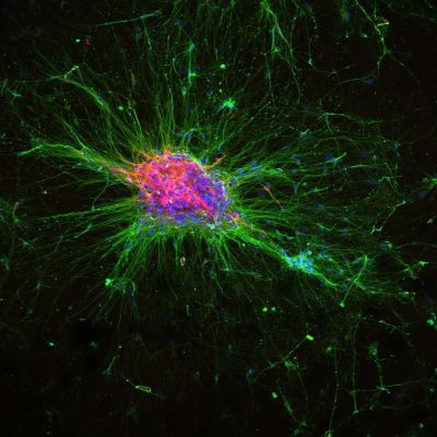 iPSC 衍生类器官分化产生多巴胺能神经元的显微图像。