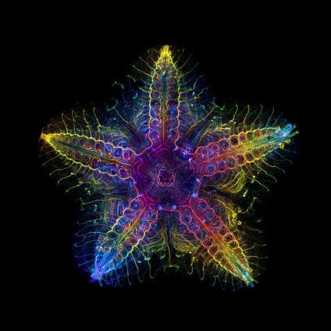 2022年IOTY大奖赛全球奖得主展示了显微镜下的幼年海星